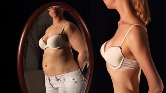 فقدان الشهية العصابي