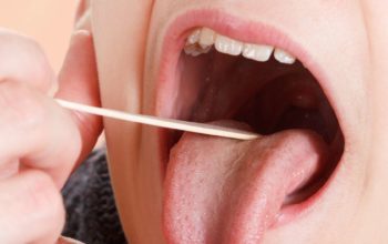 سرطان الحنك الرخو