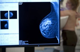 الفحص المبكر لسرطان الثدي