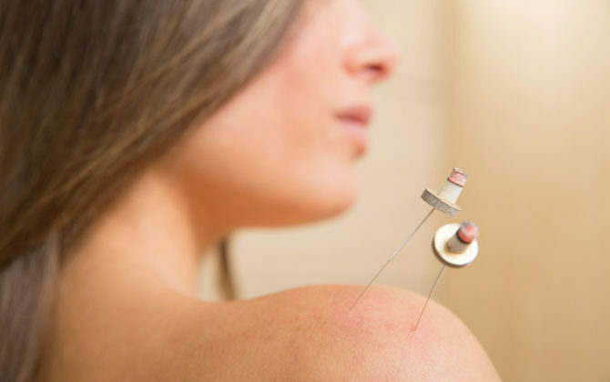 العلاج بالكي : فوائده وأضراره!