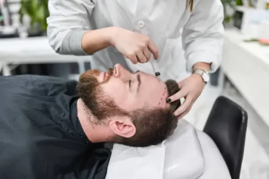 زراعة الشعر