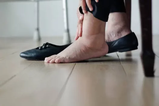 تورم القدمين