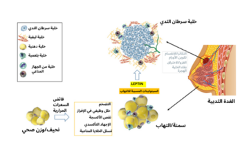 علاقة السمنة بسرطان الثدي