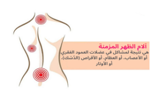  آلام الظهر المزمنة
