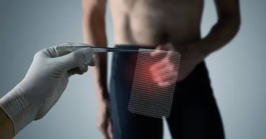 كيف أتعافى من عملية الفتق بدون جراحة