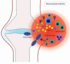 تقليل الالتهاب